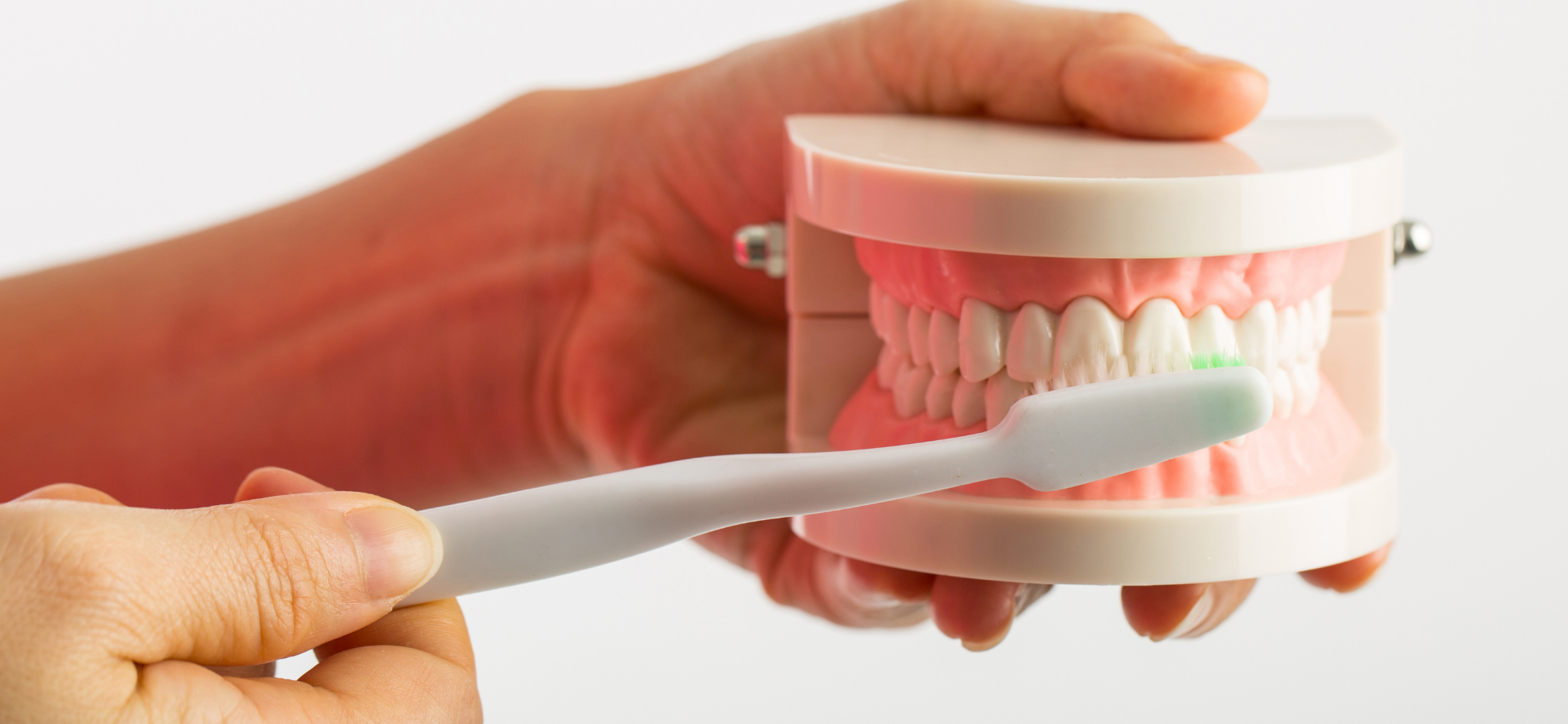 How to care for dental implants
